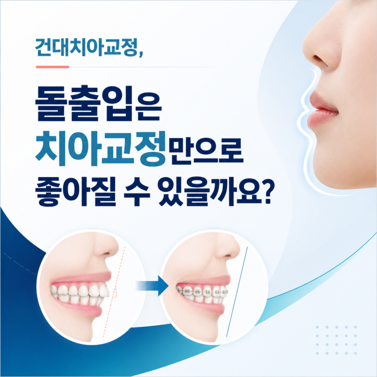 건대치아교정, 돌출입은 치아교정만으로 좋아질 수 있을까요? 관련 이미지 1