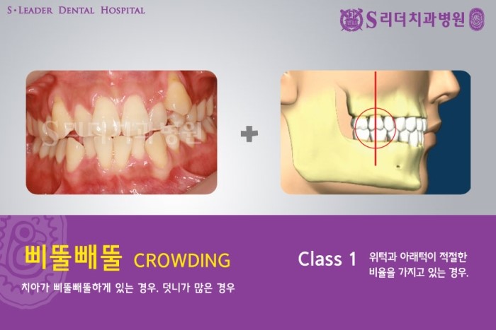 건대교정치과 내 마음에 쏙 드는 교정치과 어때요? 관련 이미지 4