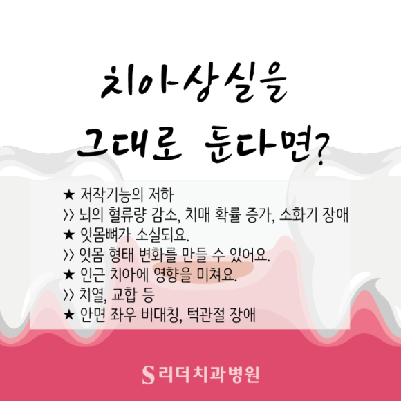 어금니깨짐 부러짐 깊은 파절 방치하지 말고 관련 이미지 2
