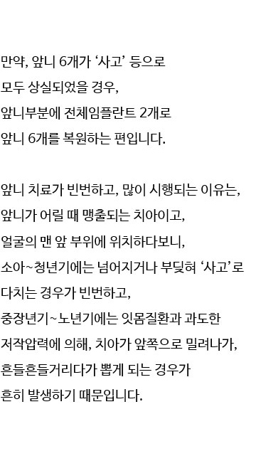 앞니임플란트 2개로 6개치아 완성 관련 이미지 3