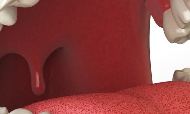 서울치과병원 초고령화사회일 수록 노인임플란트 혜택 받아보세요 관련 이미지 21