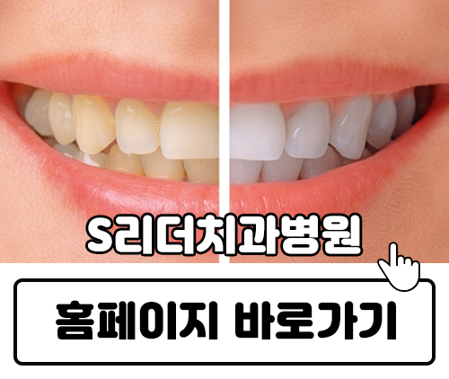 건대미백 치과 치아착색을 일으키는 식품 관련 이미지 6