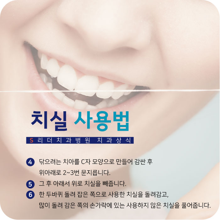 구의역치과추천 치실사용법 쉽게 알아보세요 관련 이미지 4