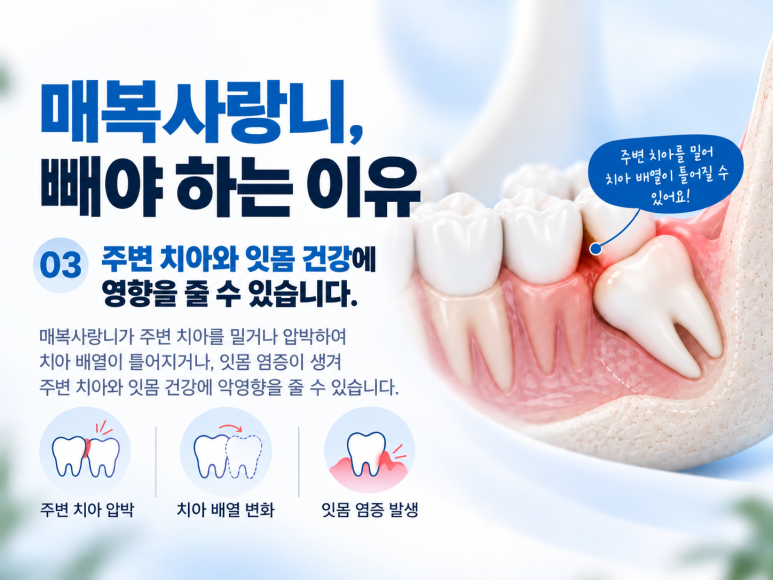 광진구치과병원 매복 사랑니는 왜 발치가 필요할까요? 관련 이미지 5