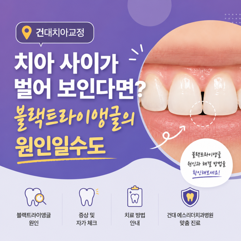 Konkuk University Orthodontics: Do Your Teeth Look Spaced Apart? It Could Be Caused by Black Triangles image 1