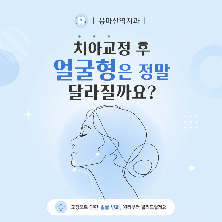 용마산역치과, 치아교정 후 얼굴형은 정말 달라질까요? 관련 이미지 1
