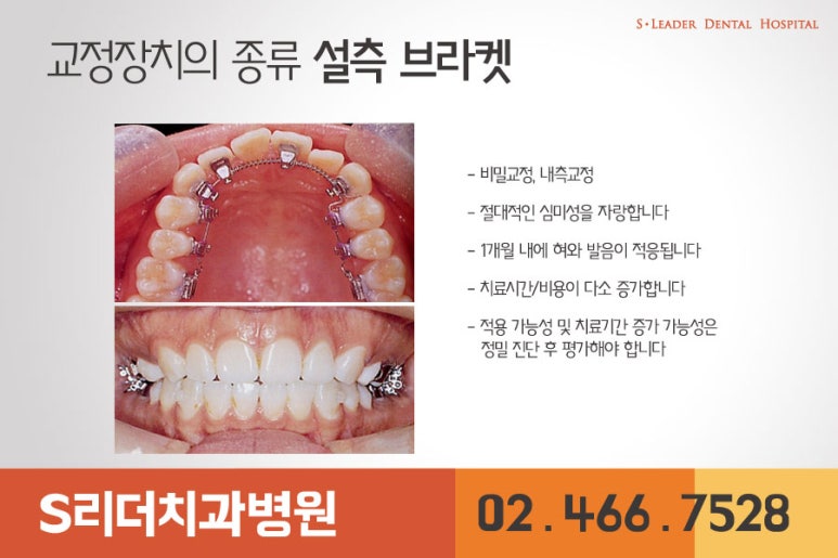 광진구교정치과 교정할때의 통증... 관련 이미지 6