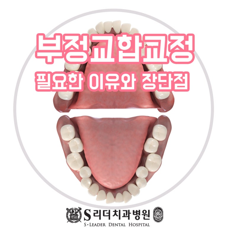 광진구치과추천 성인부정교합교정 1,2,3급 잘하는 곳에서 관련 이미지 1
