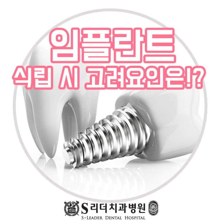 성수동치과 잇몸의 폭과 높이 외에 임플란트 식립시 고려요인은 관련 이미지 1