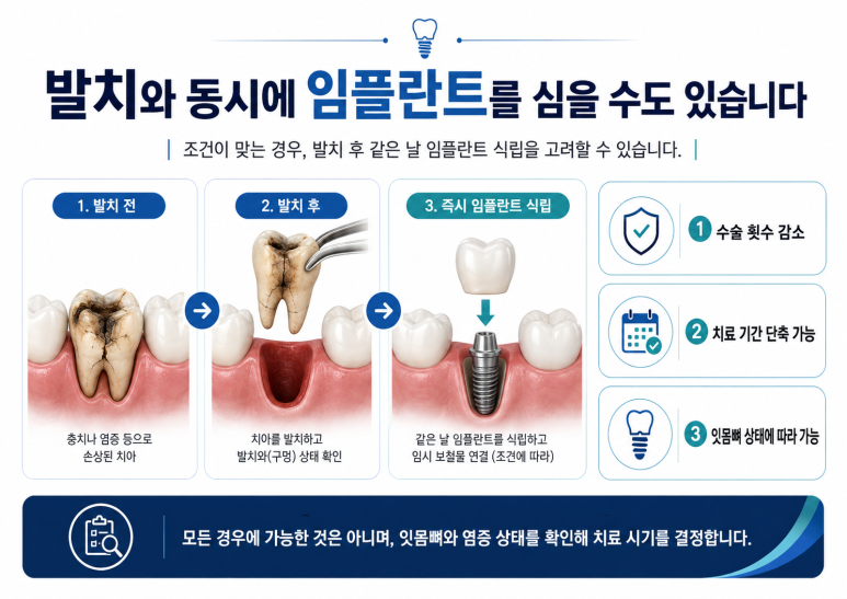 강변역치과 발치 후 임플란트, 바로 해야 할까요? 기다려야 할까요? 관련 이미지 2