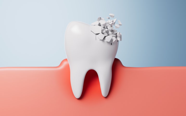 Gangbyeon Station Dental Clinic: If it hurts when you chew, suspect a cracked tooth image 2