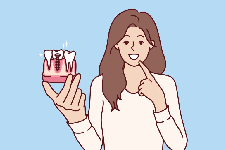 성수역임플란트, 뼈이식이 필요한 경우는? 관련 이미지 5