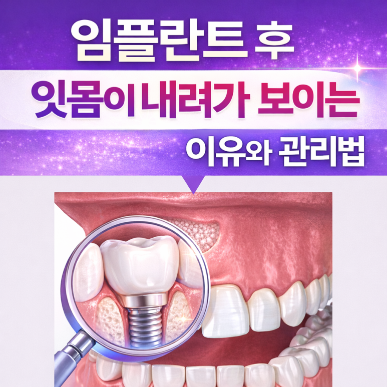 Why Does the Gums Around an Implant Appear to Recede? Care Tips from Gwangnaru Station Dental Clinic image 1