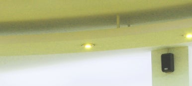 광진구교정치과 숙련된 경험과 살펴볼 점은 관련 이미지 9
