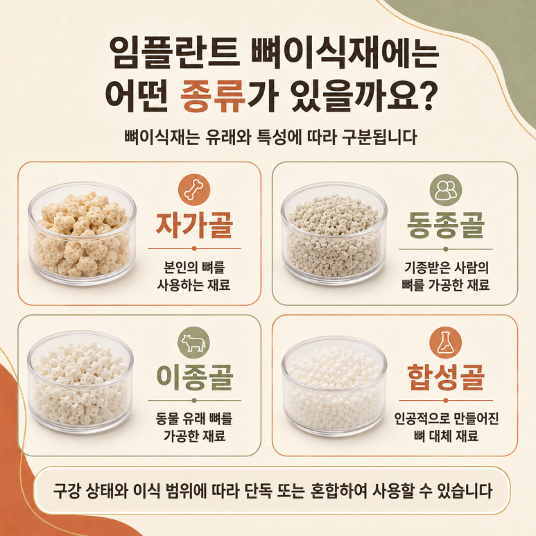 구의동임플란트 뼈이식은 어떤 경우에 필요할까요? 관련 이미지 5