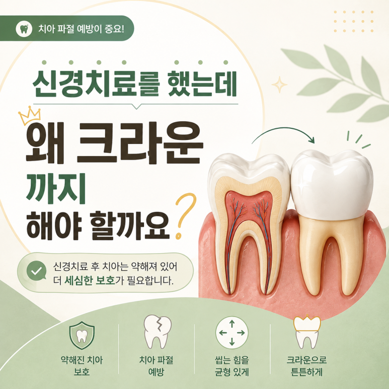 자양동치과, 신경치료를 했는데 왜 크라운까지 해야 할까요? 관련 이미지 1