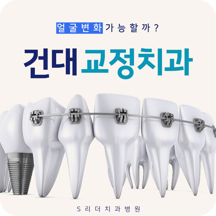 건대입구교정치과 교정얼굴변화 확인해보자 관련 이미지 1