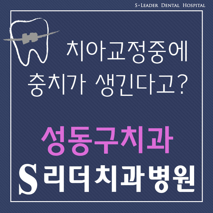 광진구~성동구치아교정치과, 치아교정중에 충치가생긴다고? 관련 이미지 1