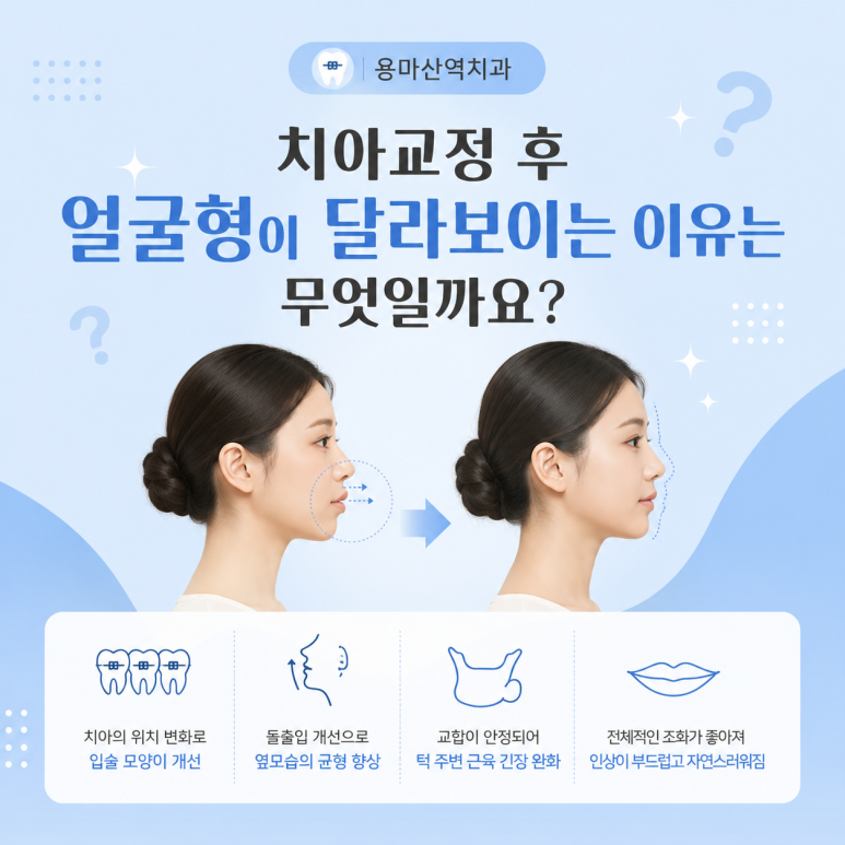용마산역치과, 치아교정 후 얼굴형은 정말 달라질까요? 관련 이미지 2