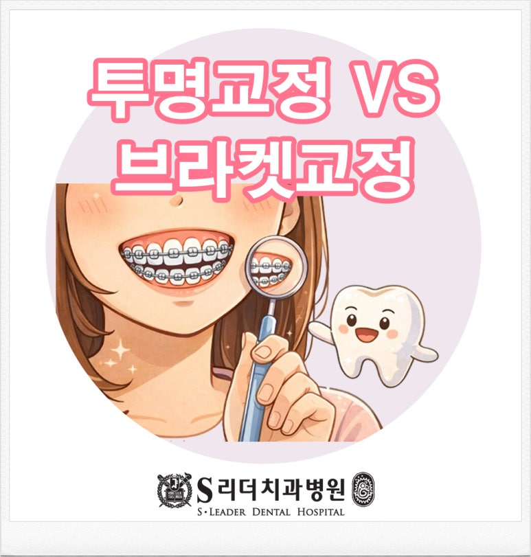Considering Orthodontic Treatment? Clear Aligners vs. Bracket Braces Compared at a Gwangjin-gu Dental Clinic image 1