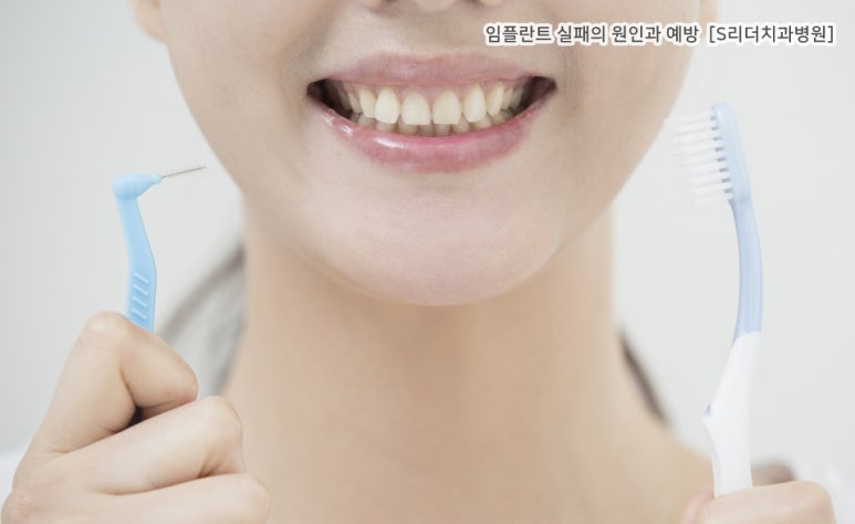 임플란트실패의 원인과 실패를 예방하는 방법은? 관련 이미지 5