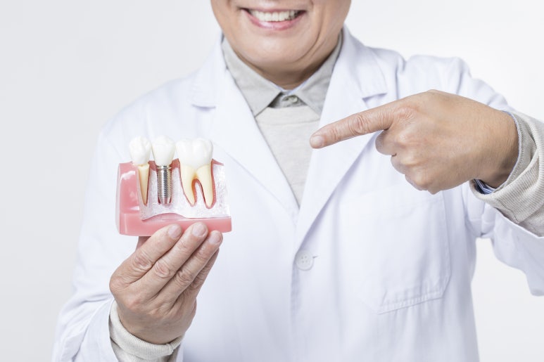 Sanggye-dong Implants | Why Bone Grafting Is Needed When There Is Not Enough Jawbone image 7