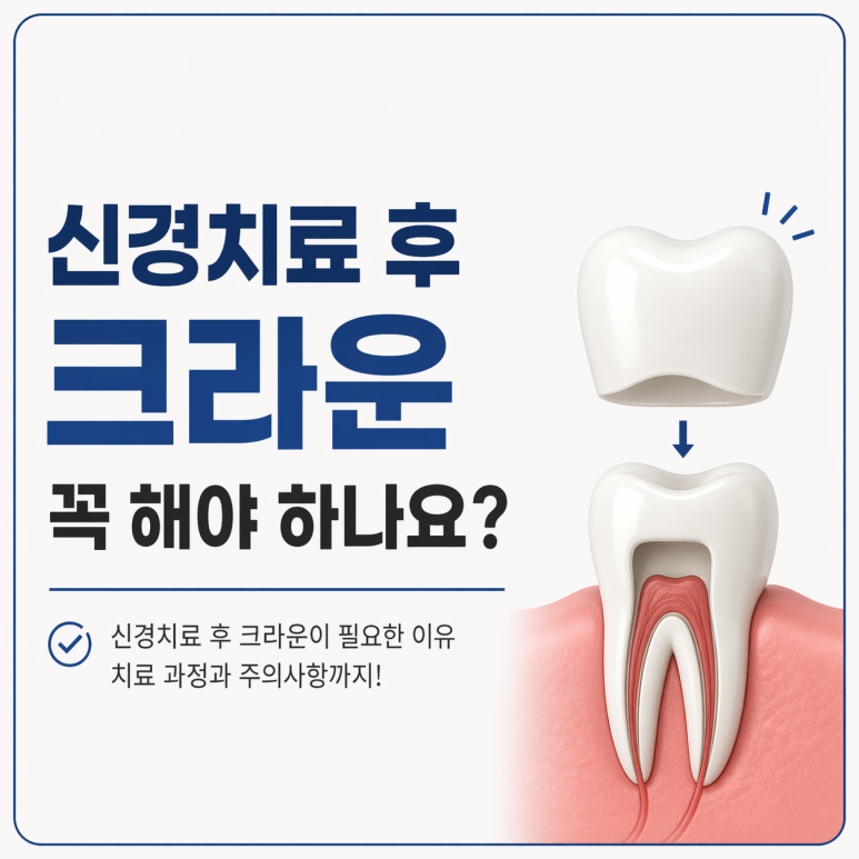 송정동치과 신경치료 후 크라운 꼭 해야 하나요? 이유까지 정리 관련 이미지 1