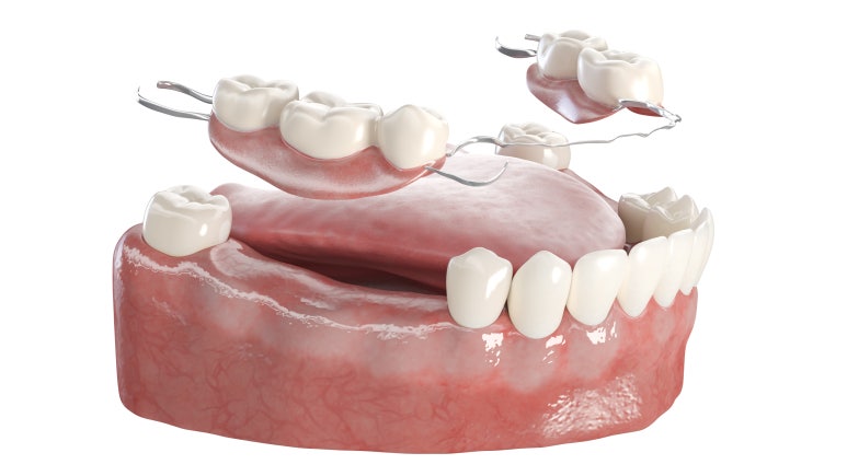 Nungdong Dental Clinic, Why Should You Wear a Retainer for at Least 1 Year? image 6