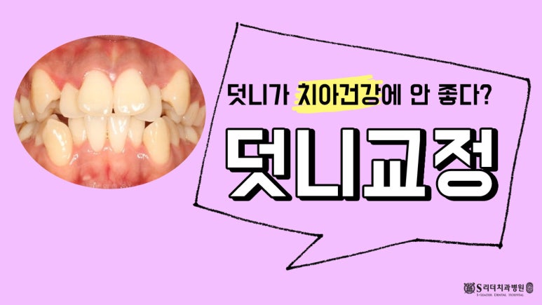 용마산역치과, 덧니 주걱턱 치아교정 개선하기 위한 과정은 관련 이미지 2