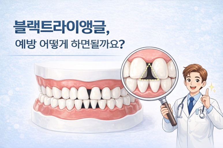 Seoul Yangsim Dental Clinic｜Why Black Triangles Form and How to Fix Them image 5