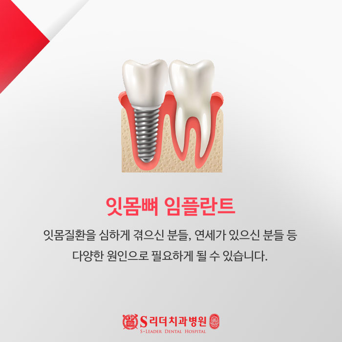 잇몸뼈임플란트 왜? 어떻게? 궁금증 해결 관련 이미지 2