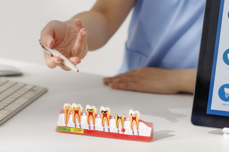 Sanggye-dong Dental Clinic: Step-by-Step Process of Cavity Treatment and Why Treatment Differs image 3