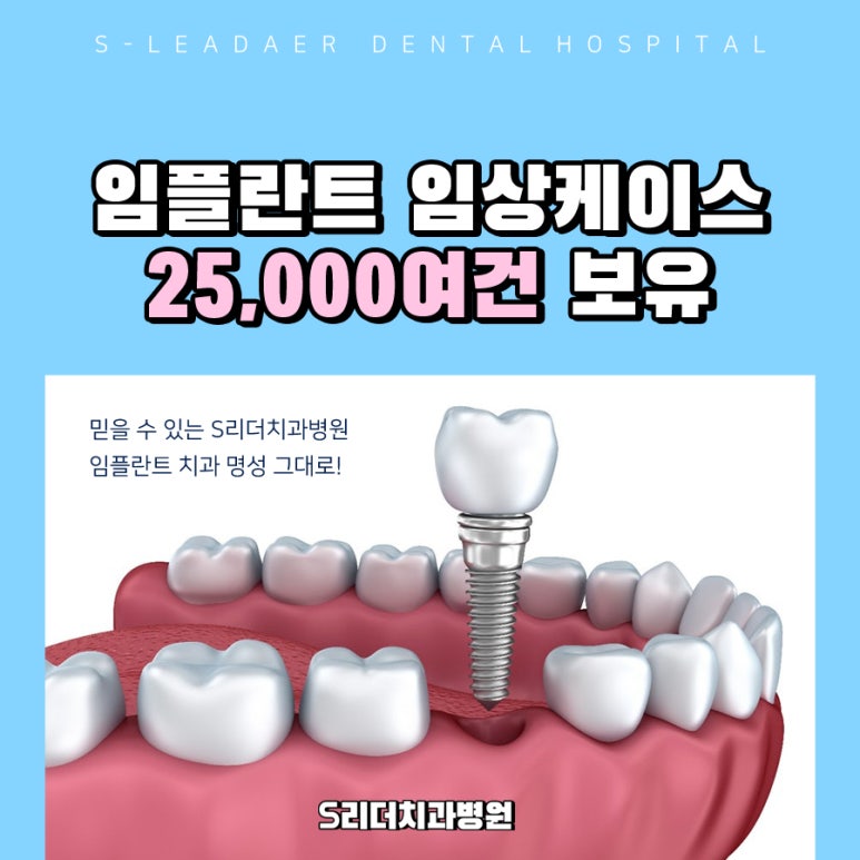 광진구임플란트|수술 후 붓기·멍 언제 빠질까? 회복 기간 총정리 관련 이미지 6