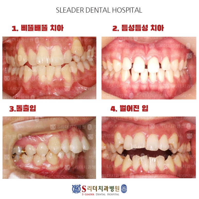 Are you looking for a trustworthy place for orthodontic treatment near Konkuk University Station? image 6