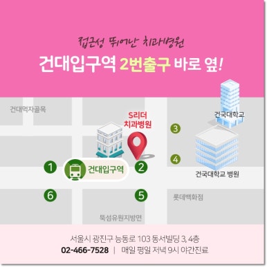 동대문구치과|교정 후 블랙트라이앵글, 왜 생길까? 레진으로 메울 수 있을까 관련 이미지 11