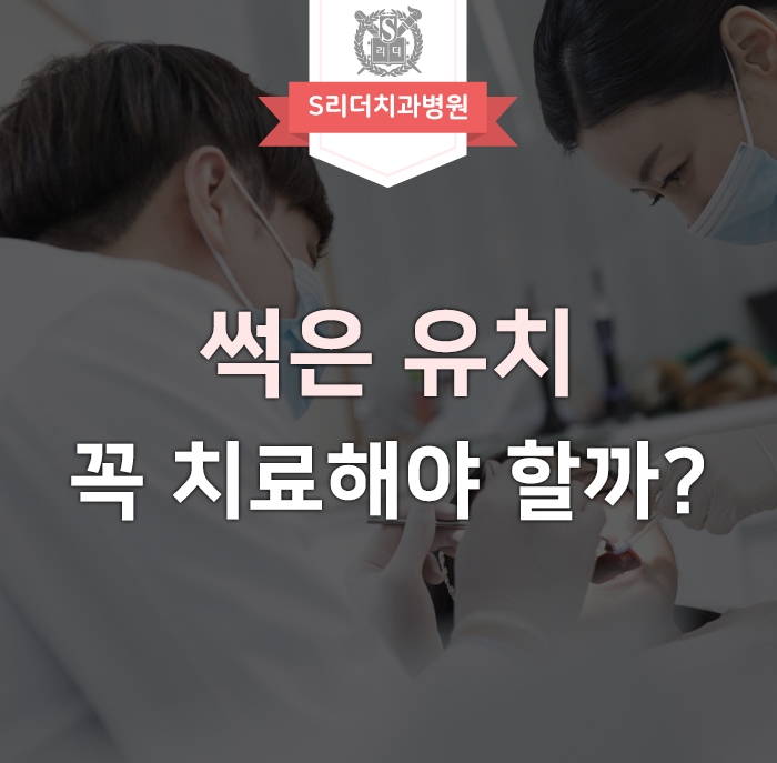 썩은 유치 치료 왜 해야 하는지 이유 알아보기 관련 이미지 1