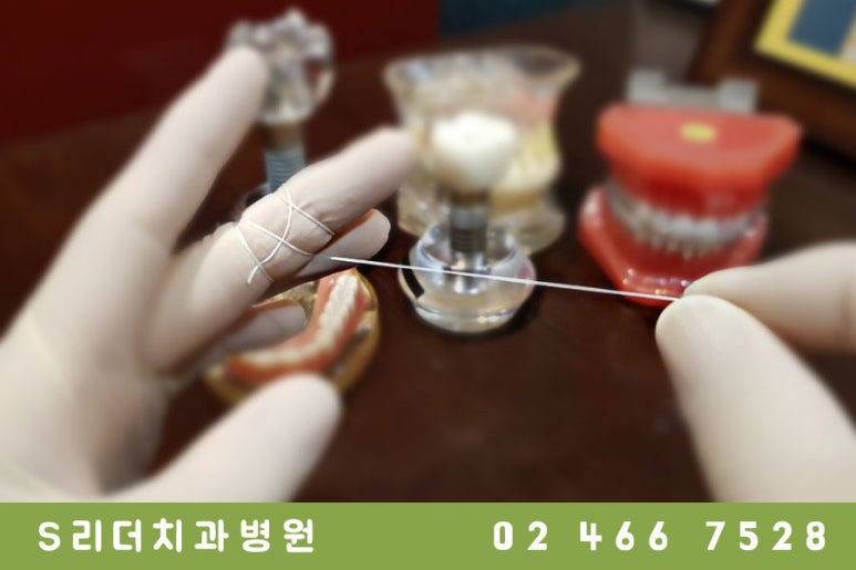 구강관리에 효과적인 치실사용법! 관련 이미지 3