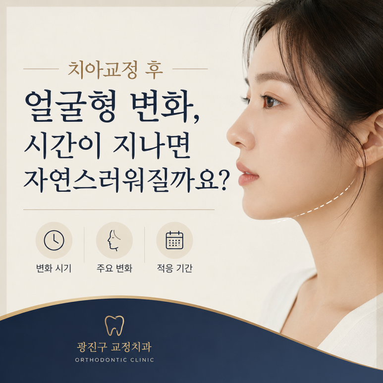 광진구교정치과 치아교정 후 얼굴형 변화, 시간이 지나면 자연스러워질까요? 관련 이미지 1