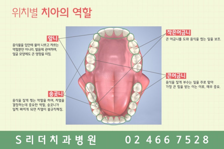 어금니임플란트 왜자꾸반복될까? 관련 이미지 6