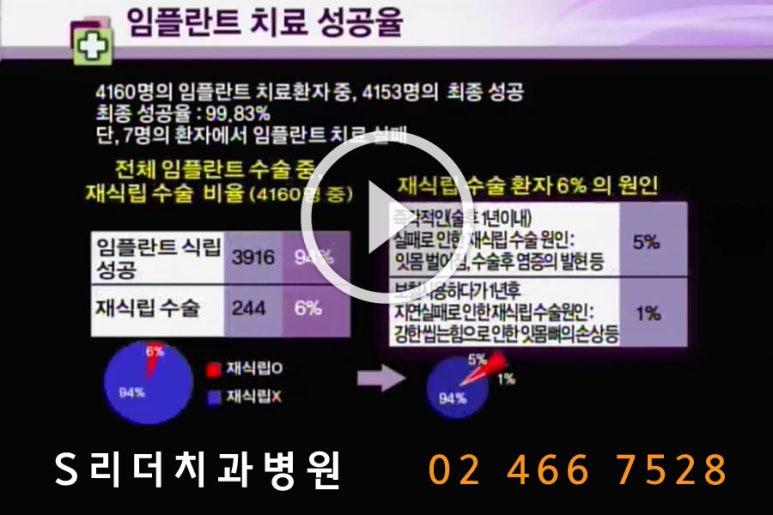 건대치과 임플란트 잘하는 곳에서 관련 이미지 5