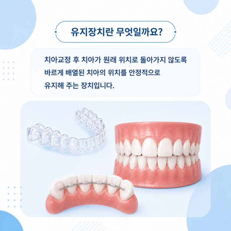 건대치아교정, 교정 후 유지장치는 평생 착용해야 할까요? 관련 이미지 2