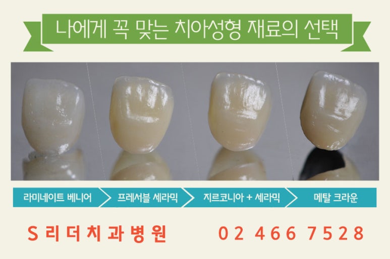앞니치아성형 내마음에 쏙~들려면 관련 이미지 6