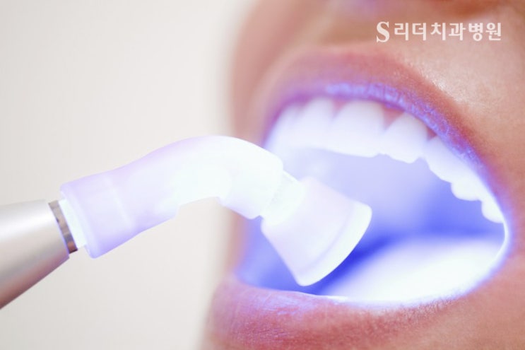건대미백 치과 치아착색을 일으키는 식품 관련 이미지 5