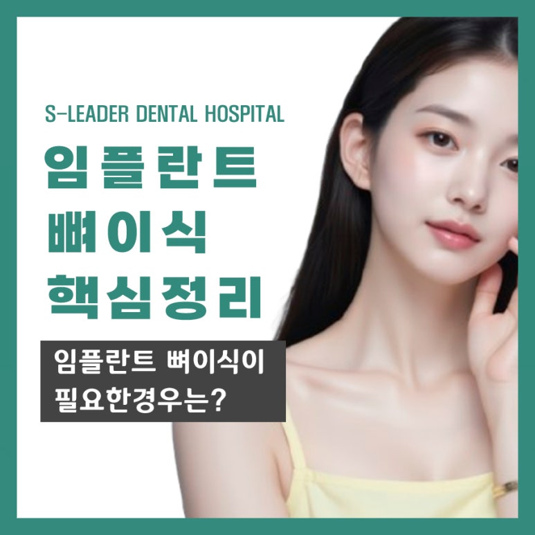 성수역임플란트, 뼈이식이 필요한 경우는? 관련 이미지 1