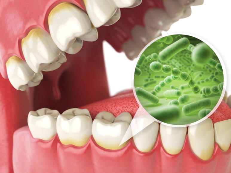 Cavity Prevention: Managing 1% Each Day to Protect Lifelong Dental Health image 1