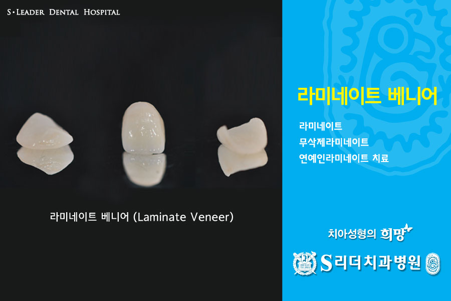 자양동치아미백 치과 누런이 관리하는 방법 관련 이미지 18