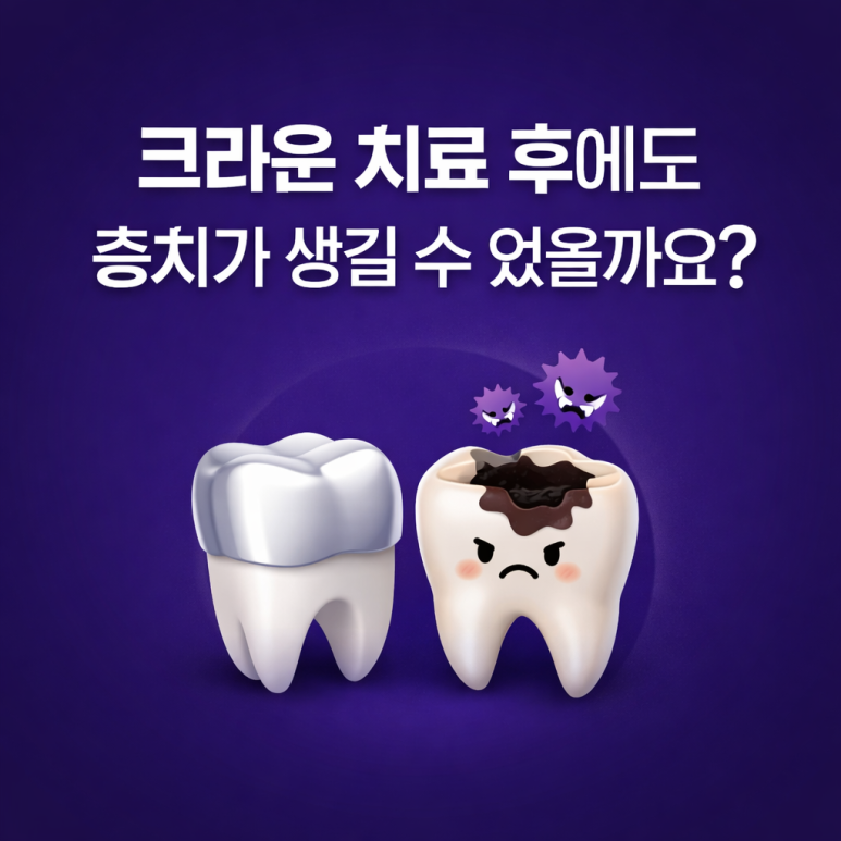 Guwi-dong Dental Clinic: Can Cavities Develop Even After Crown Treatment? image 1