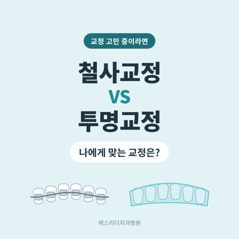 자양동치과, 철사 교정 vs 투명교정, 나에게 맞는 건 뭘까? 관련 이미지 1
