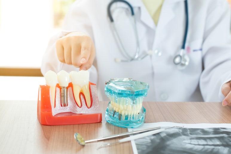 Age-Based Dental Care: Which Treatments Are Most Common? Find Out at Sagajeong Station Dental Clinic image 5