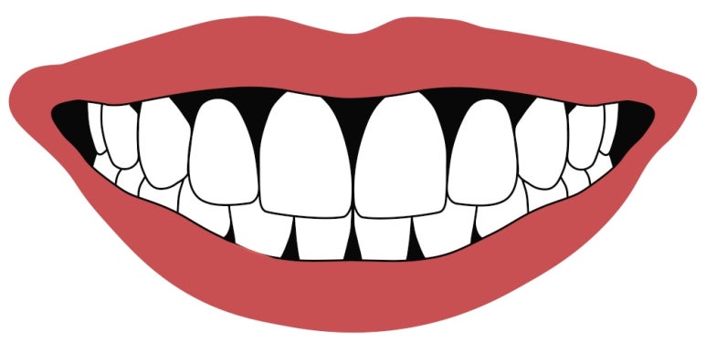 Jungnang-gu Orthodontic Clinic: Can protruding buck teeth be corrected with partial orthodontics? image 5